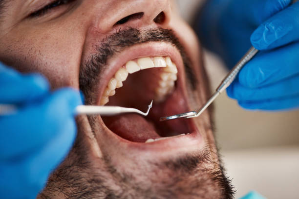 Best Same-Day Emergency Dentist in Shepherd, MI